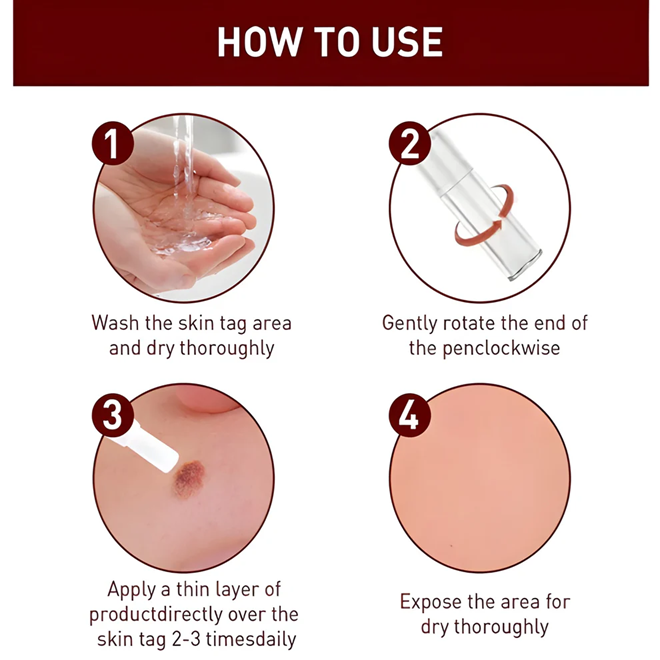 Tags & Moles Remover (Buy 1 Get 1 Free)