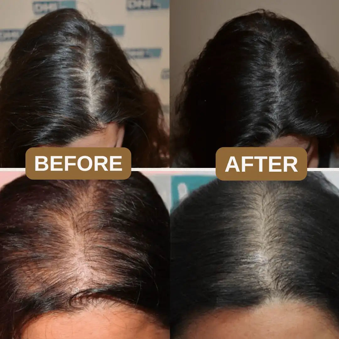 Rosemary Keratin Boost Hair Growth Shampoo (Buy 1 Get 1 Free)