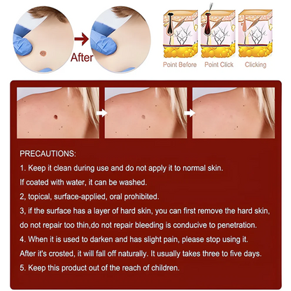 Tags & Moles Remover (Buy 1 Get 1 Free)